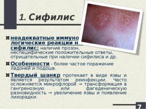 Симптомы сифилиса или вич