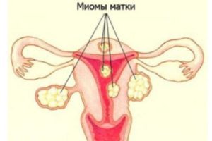 Появление месячных через 10 дней после предыдущих