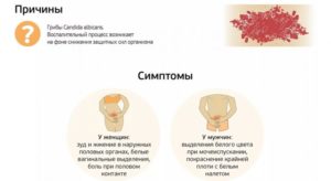 Баквагиноз? Зуд, жжение. Флуконазол не помог