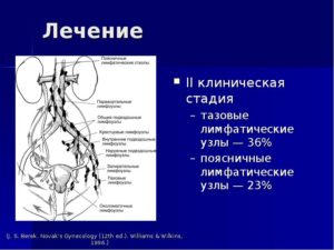 Лимфоузлы на пояснице
