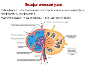Лимфоузел структурно измененный