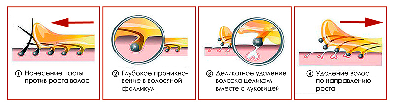 Инструкция по проведению шугаринга
