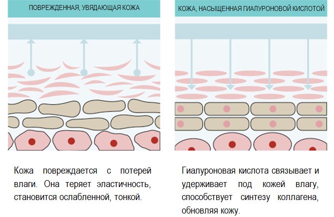 Механизм действия гиалуроновой кислоты
