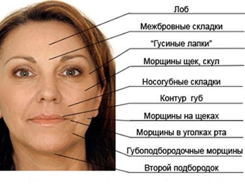 Области применения инъекций Диспорта